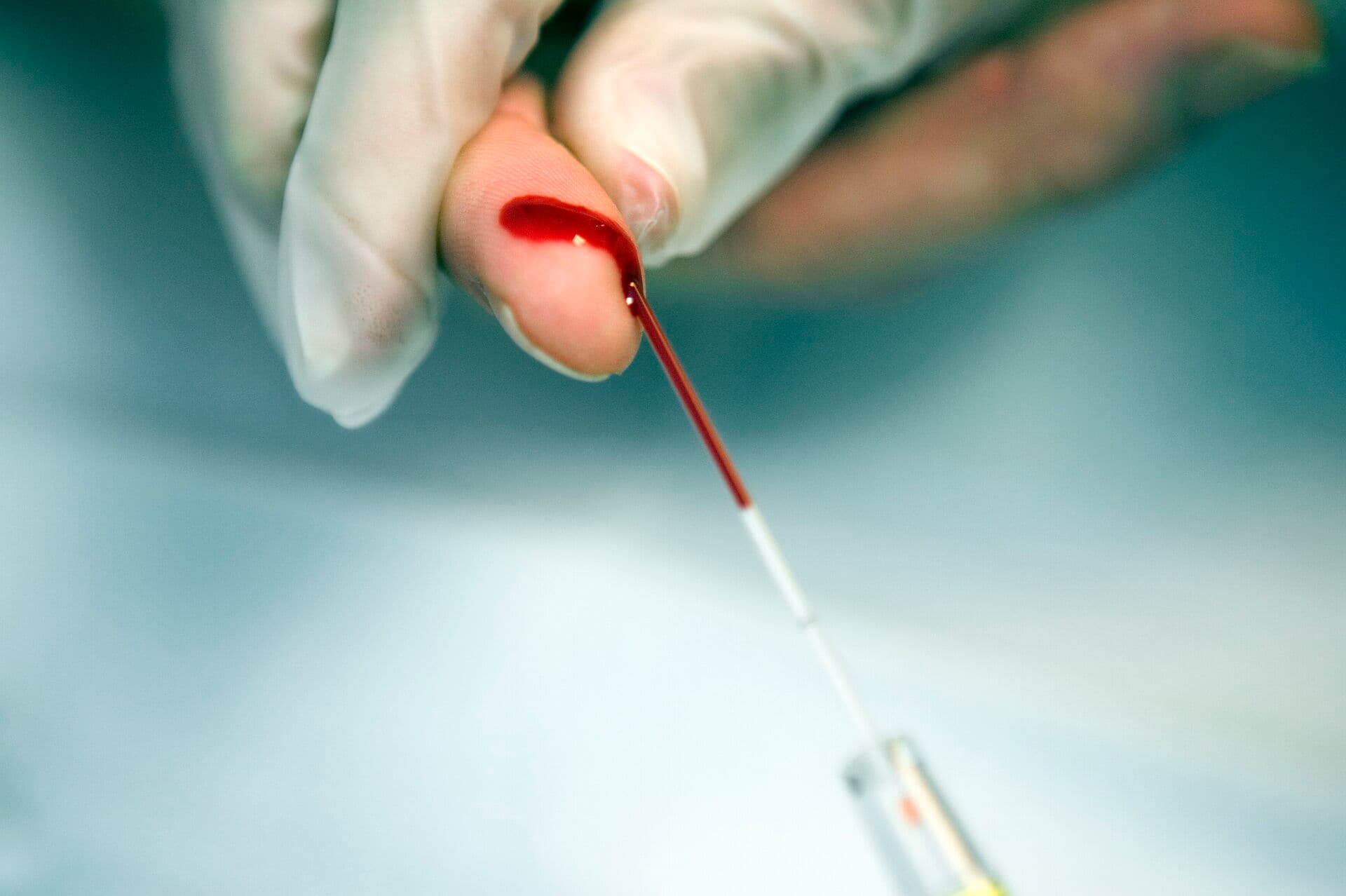 Kvaliteten af et analysesvar afhænger af, hvilken kommune man bor i. Det kan have alvorlige konsekvenser, advarer fagfolk. 